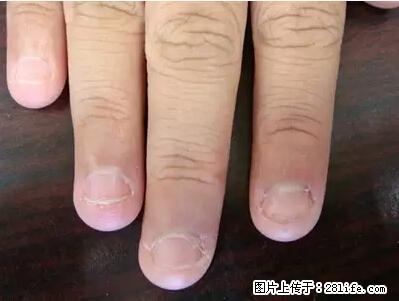 剪指甲、挖耳屎，这些日常小动作竟隐藏大危害！ - 黄冈生活资讯 - 黄冈28生活网 hg.28life.net